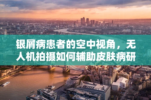 银屑病患者的空中视角，无人机拍摄如何辅助皮肤病研究？