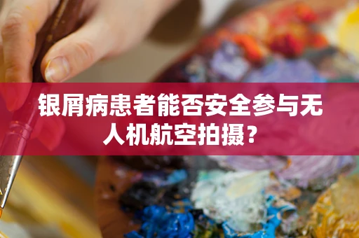 银屑病患者能否安全参与无人机航空拍摄？