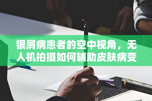 银屑病患者的空中视角，无人机拍摄如何辅助皮肤病变监测？