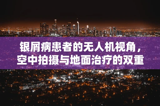 银屑病患者的无人机视角，空中拍摄与地面治疗的双重挑战