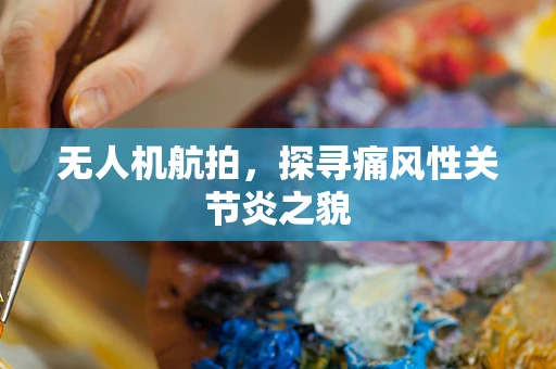 无人机航拍，探寻痛风性关节炎之貌